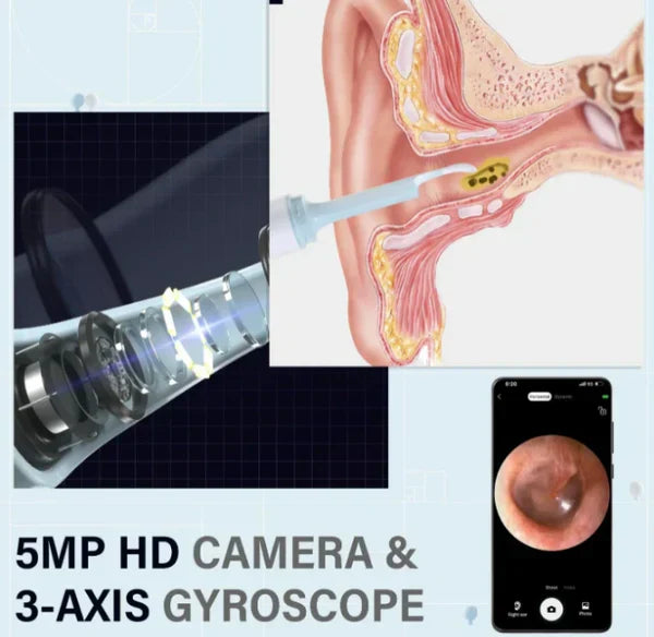 OtoScope+® Limpiador de oído cámara 4k📸 + Obsequios de 4 cabezales