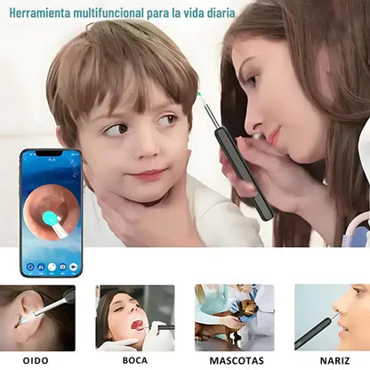 OtoScope+® Limpiador de oído cámara 4k📸 + Obsequios de 4 cabezales